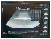 Jcm 13 03440 i046 Jcm 13 03440 i046