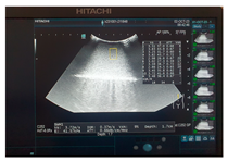 Jcm 13 03440 i047 Jcm 13 03440 i047