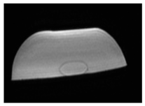 Jcm 13 03440 i055 Jcm 13 03440 i055