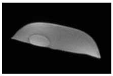 Jcm 13 03440 i056 Jcm 13 03440 i056