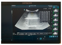 Jcm 13 03440 i062 Jcm 13 03440 i062