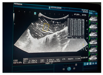 Jcm 13 03440 i063 Jcm 13 03440 i063