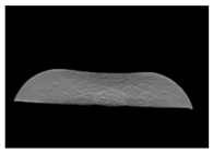 Jcm 13 03440 i064 Jcm 13 03440 i064