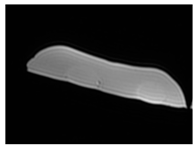 Jcm 13 03440 i067 Jcm 13 03440 i067