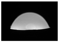 Jcm 13 03440 i068 Jcm 13 03440 i068