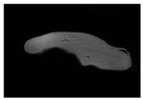 Jcm 13 03440 i069 Jcm 13 03440 i069