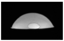 Jcm 13 03440 i071 Jcm 13 03440 i071