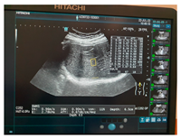 Jcm 13 03440 i076 Jcm 13 03440 i076