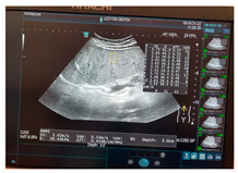 Jcm 13 03440 i078 Jcm 13 03440 i078