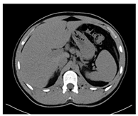 Jcm 13 03440 i079 Jcm 13 03440 i079