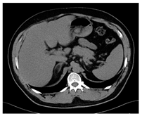 Jcm 13 03440 i080 Jcm 13 03440 i080