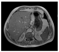 Jcm 13 03440 i082 Jcm 13 03440 i082