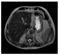 Jcm 13 03440 i085 Jcm 13 03440 i085