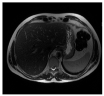 Jcm 13 03440 i086 Jcm 13 03440 i086