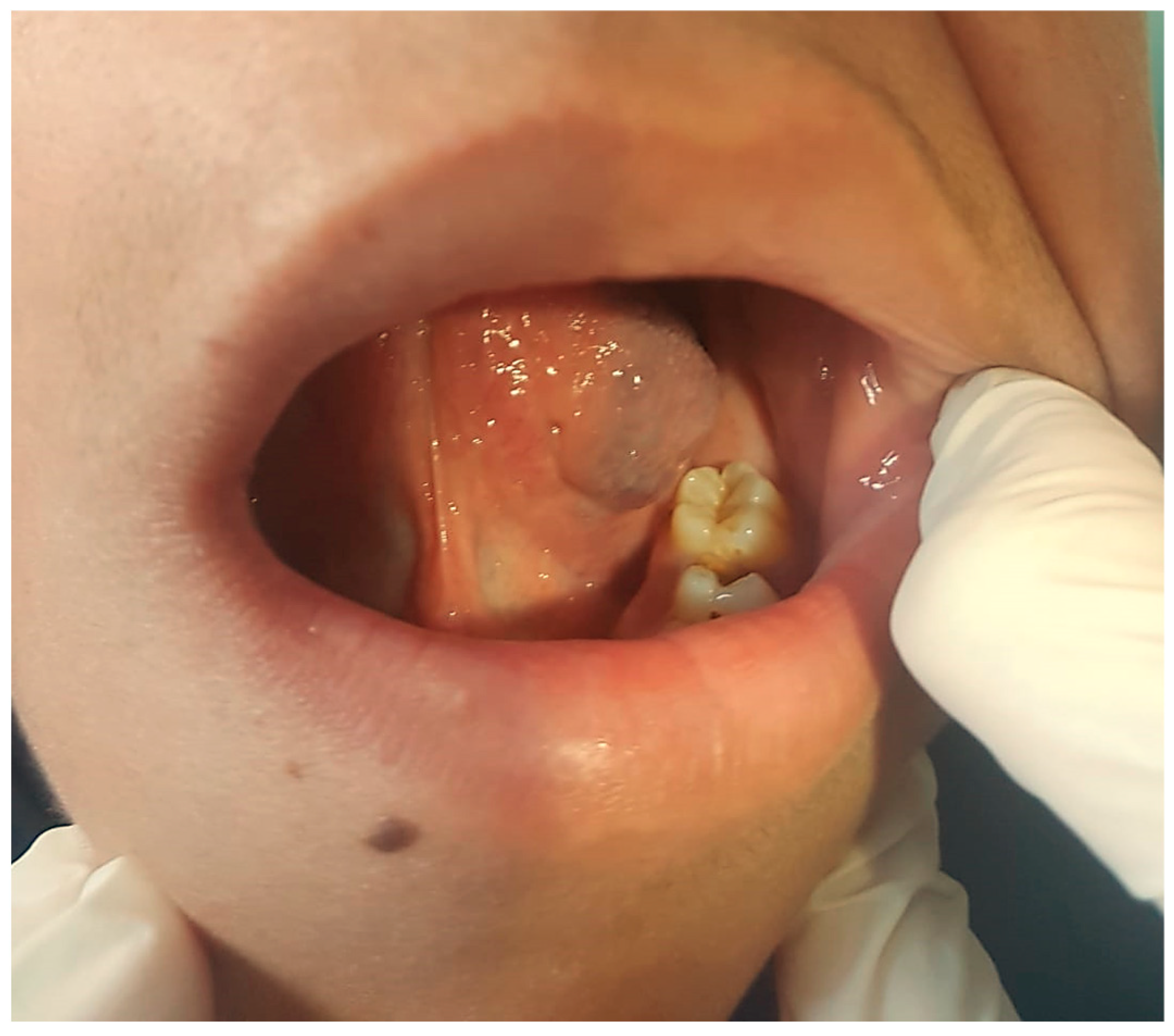 Jcm 13 03515 g001 Jcm 13 03515 g001