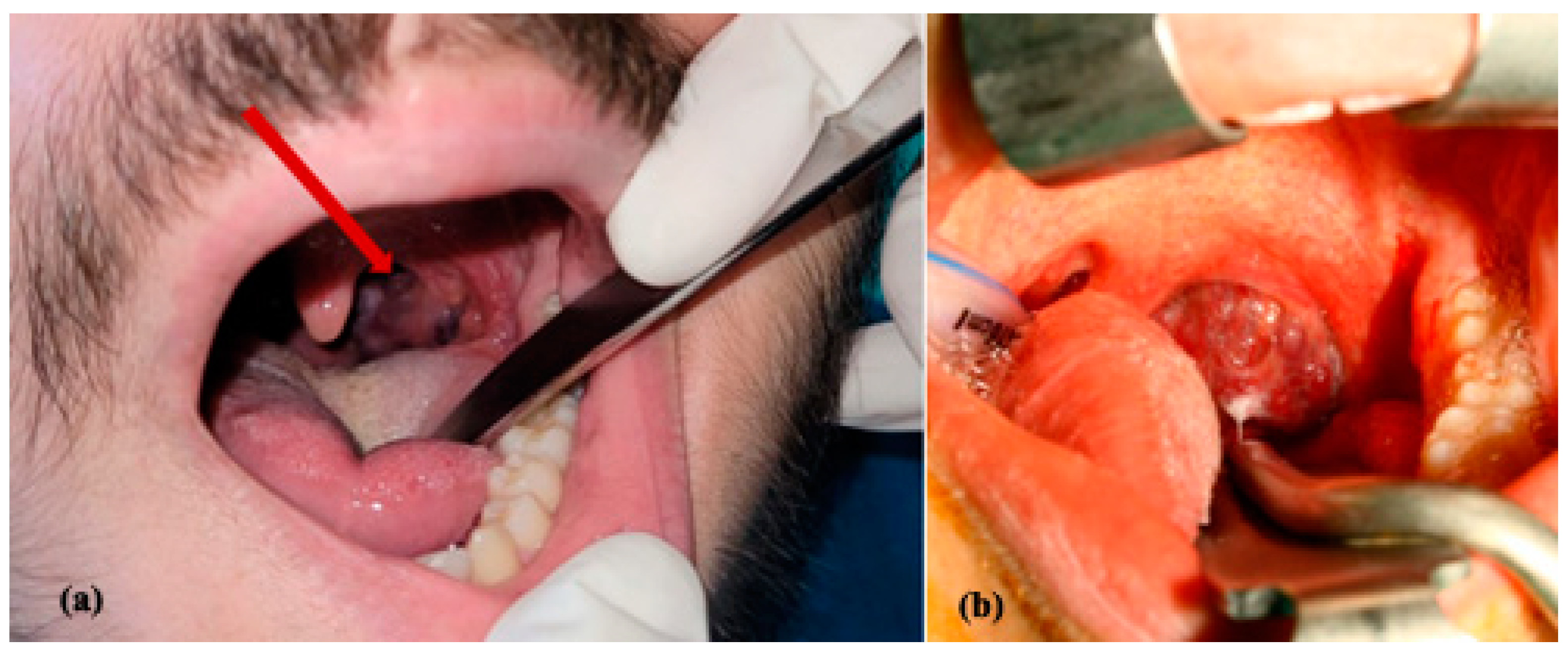 Jcm 13 03515 g002 Jcm 13 03515 g002