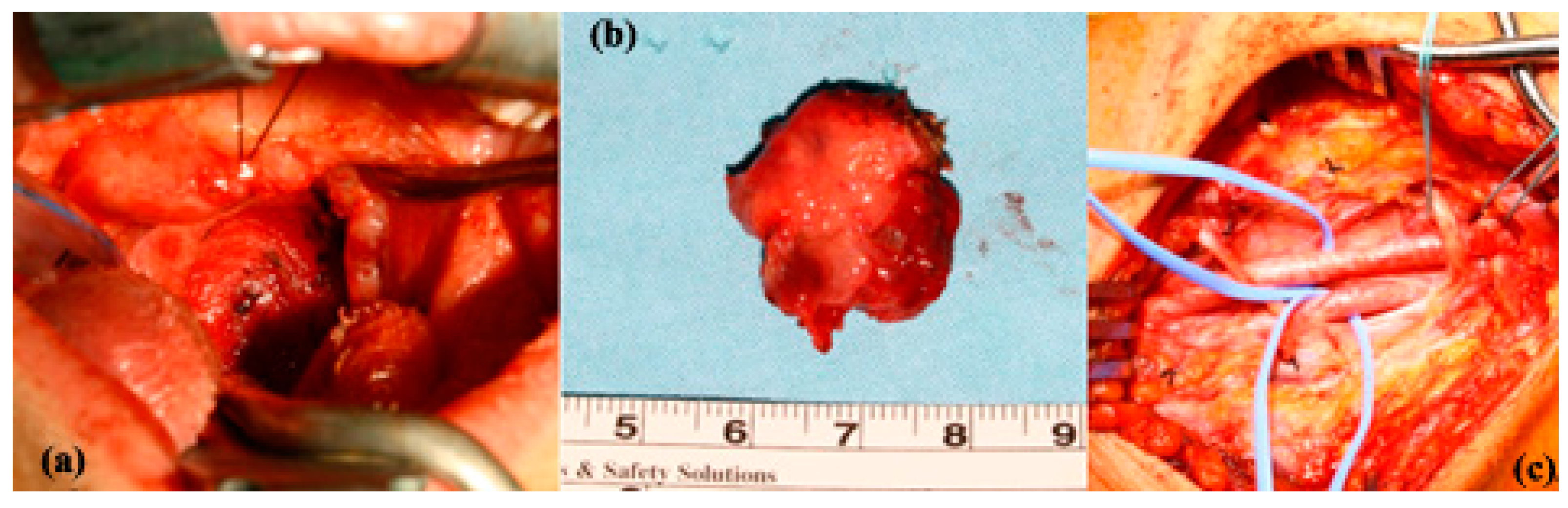 Jcm 13 03515 g004 Jcm 13 03515 g004
