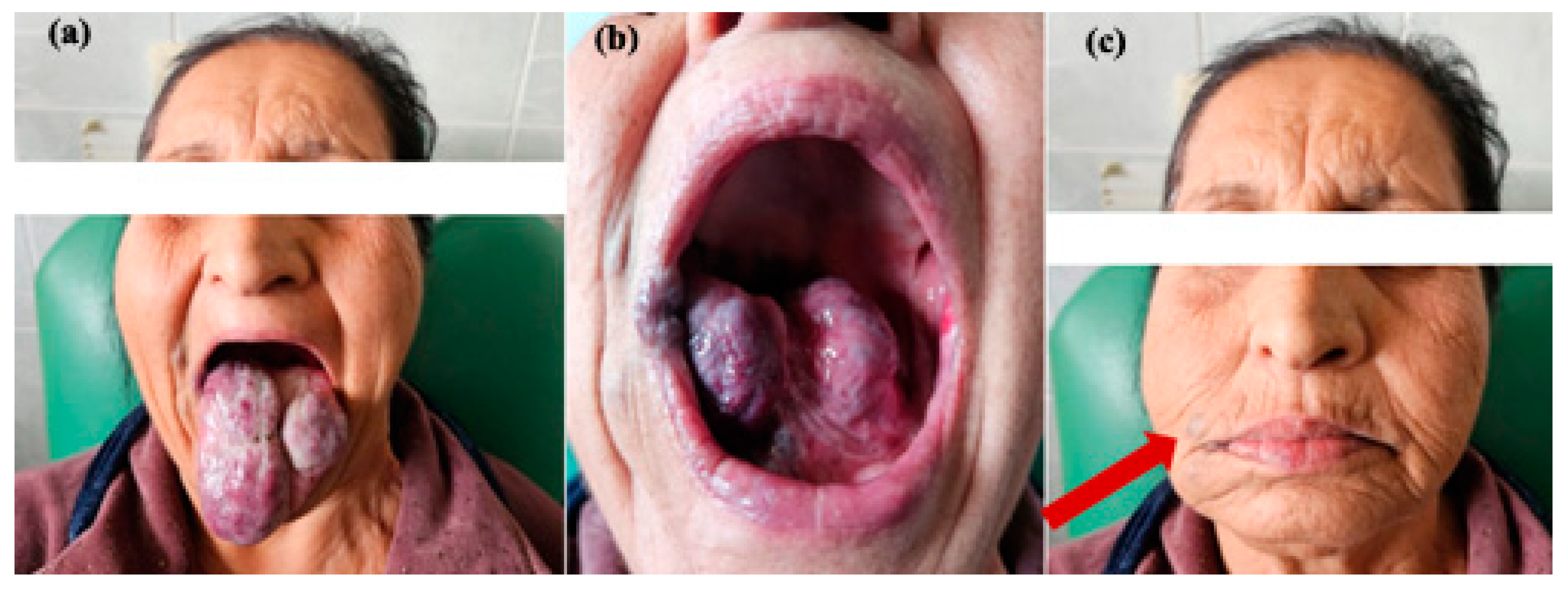 Jcm 13 03515 g005 Jcm 13 03515 g005