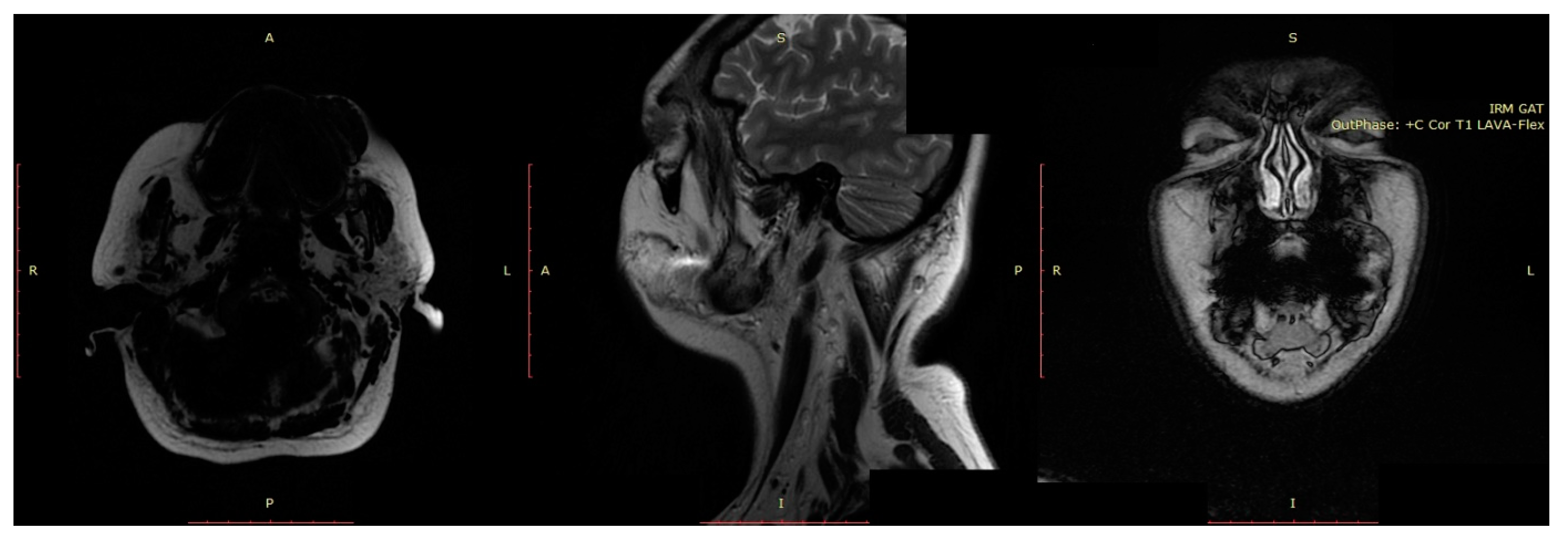 Jcm 13 03515 g006 Jcm 13 03515 g006