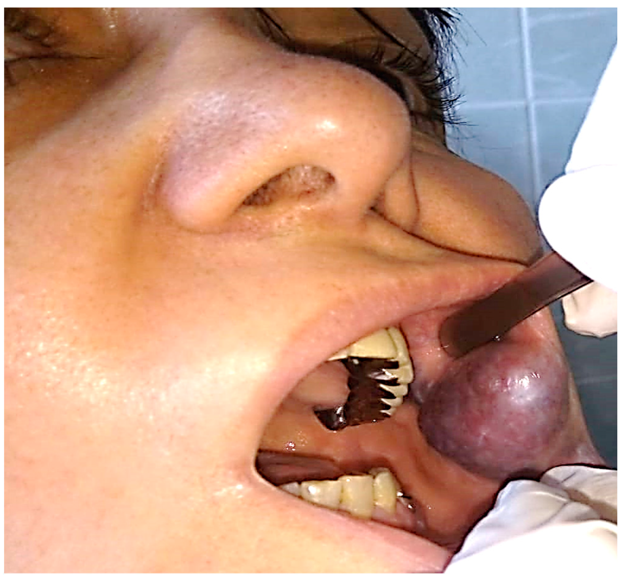 Jcm 13 03515 g008 Jcm 13 03515 g008