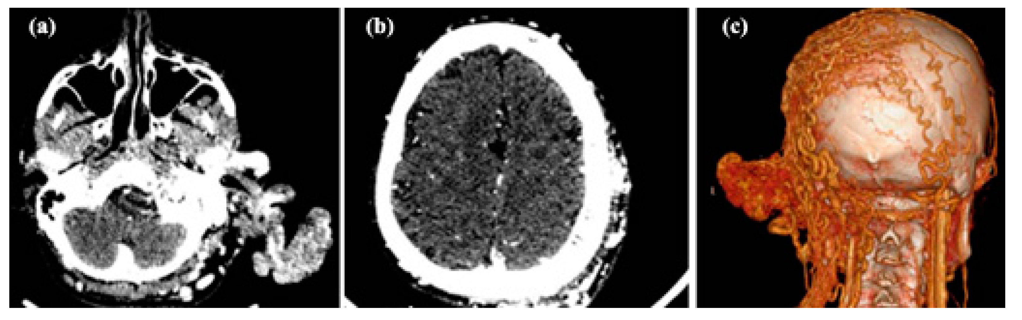 Jcm 13 03515 g010 Jcm 13 03515 g010