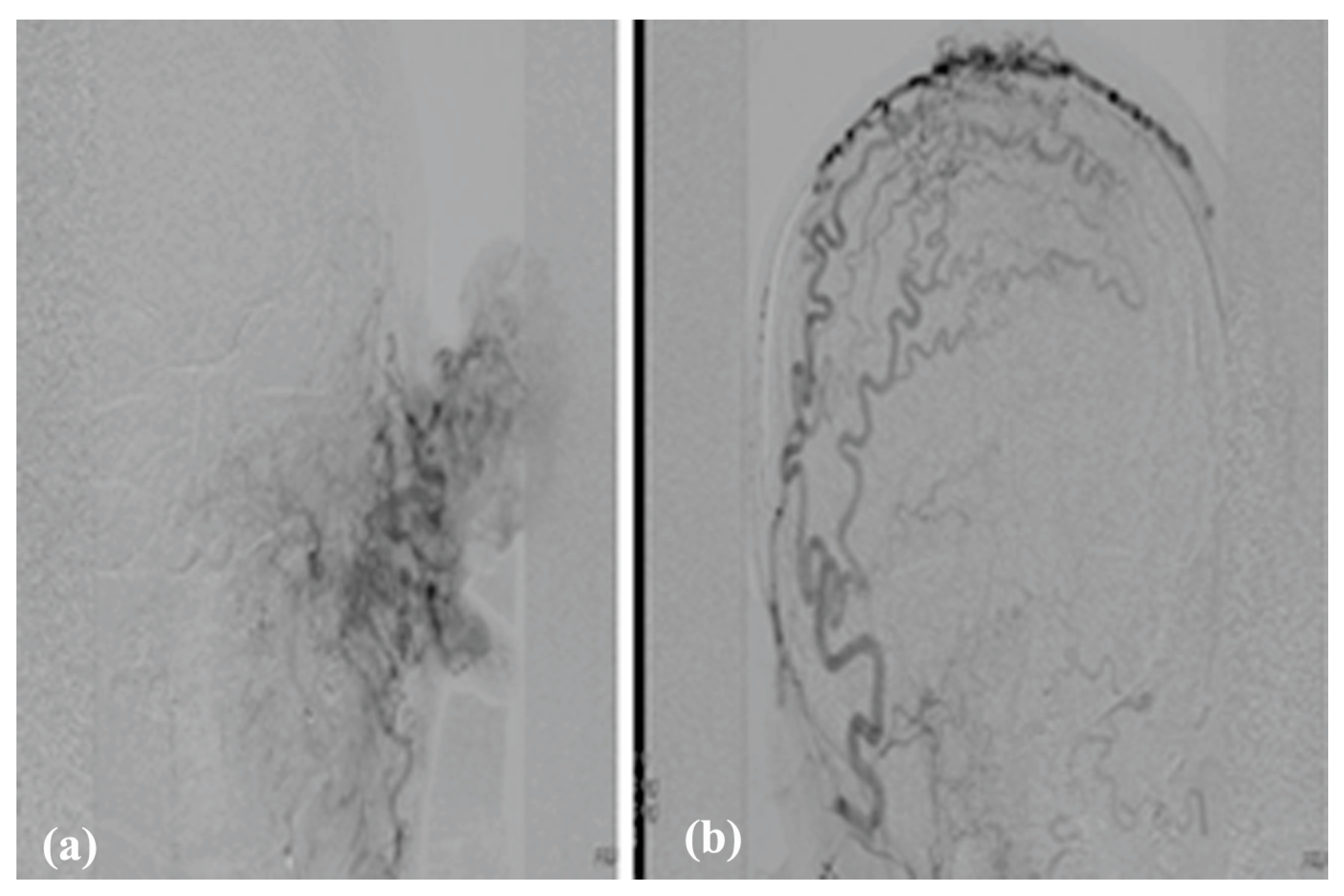 Jcm 13 03515 g011 Jcm 13 03515 g011