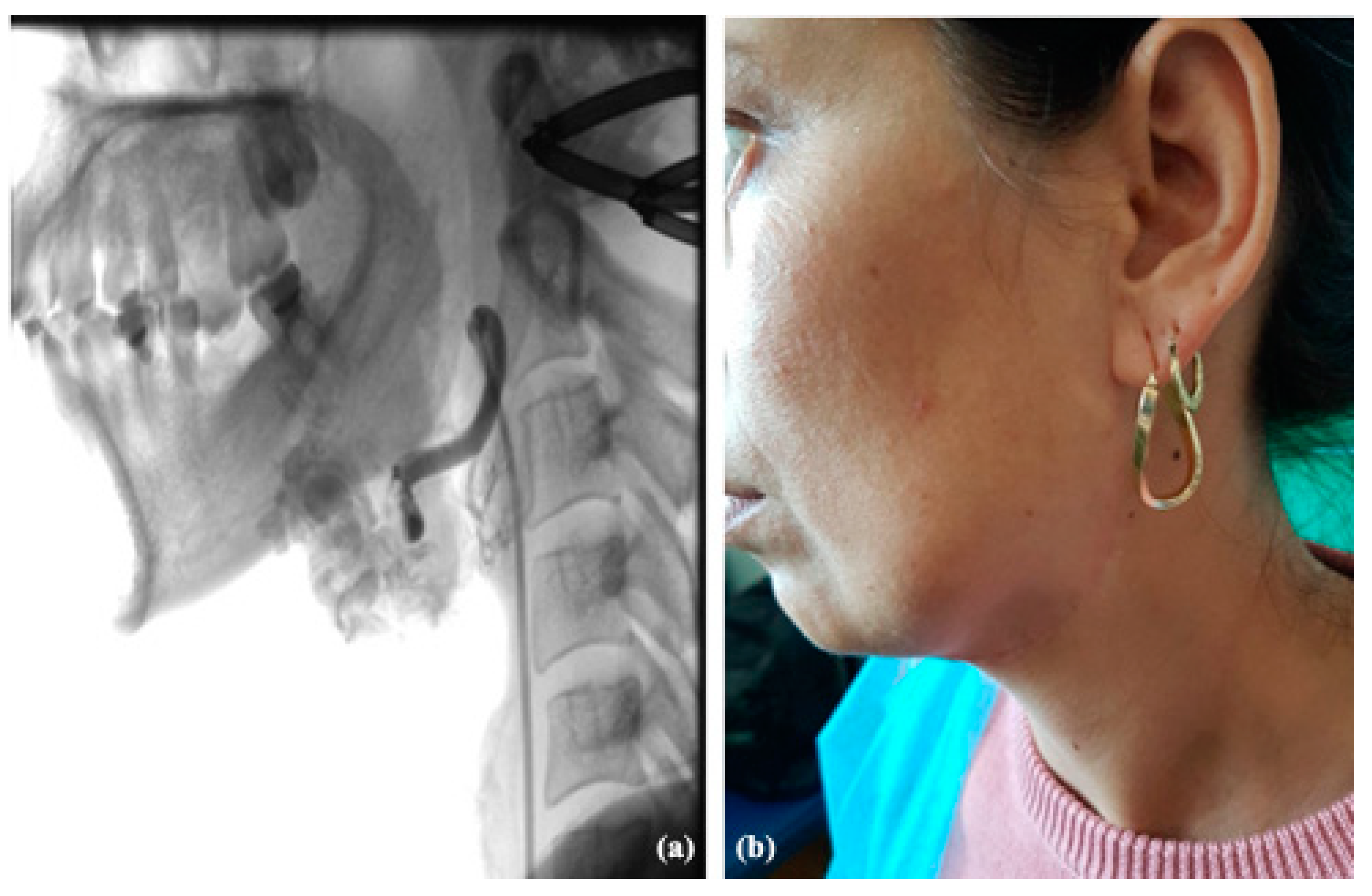 Jcm 13 03515 g012 Jcm 13 03515 g012