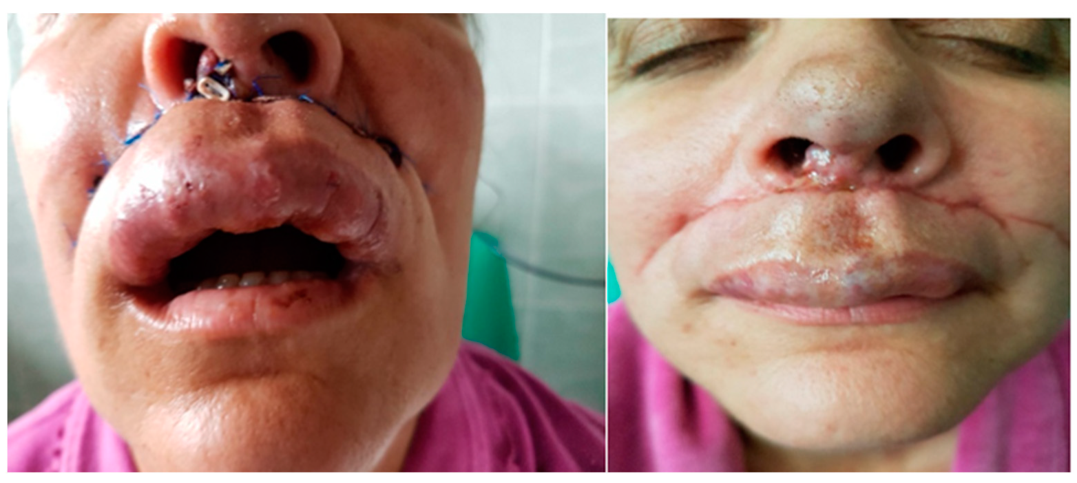 Jcm 13 03515 g015 Jcm 13 03515 g015