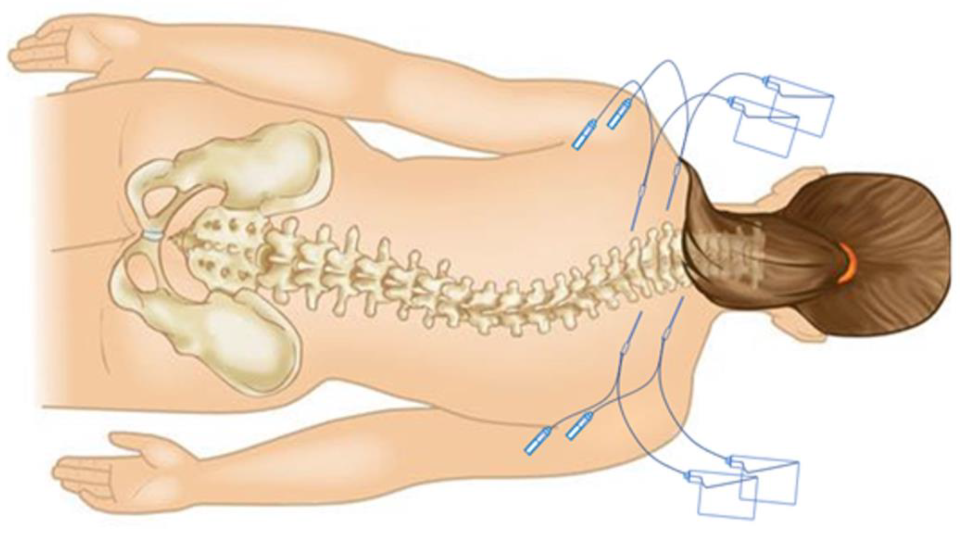 Jcm 13 03524 g002 Jcm 13 03524 g002