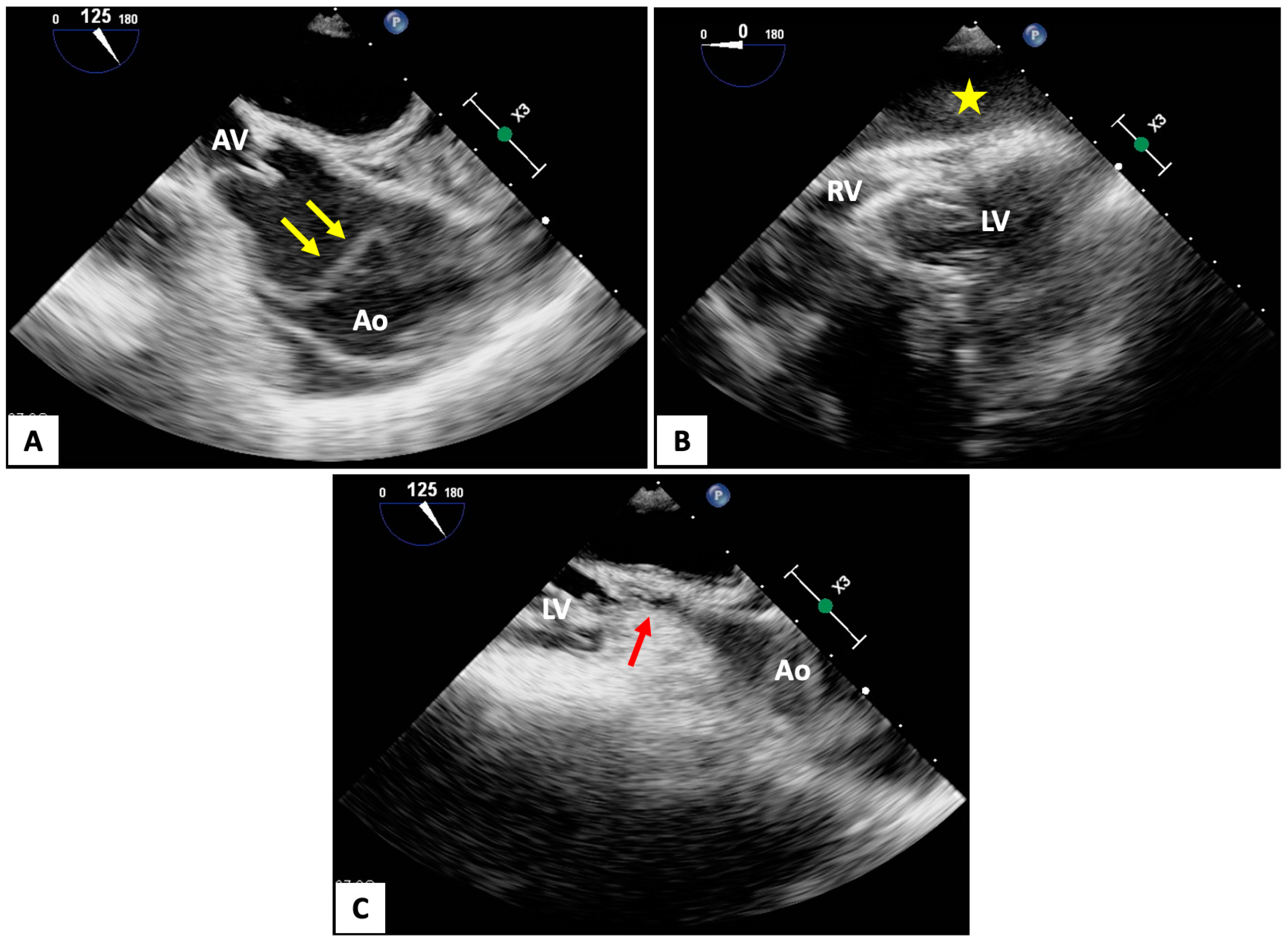 Jcm 13 03527 g002 Jcm 13 03527 g002