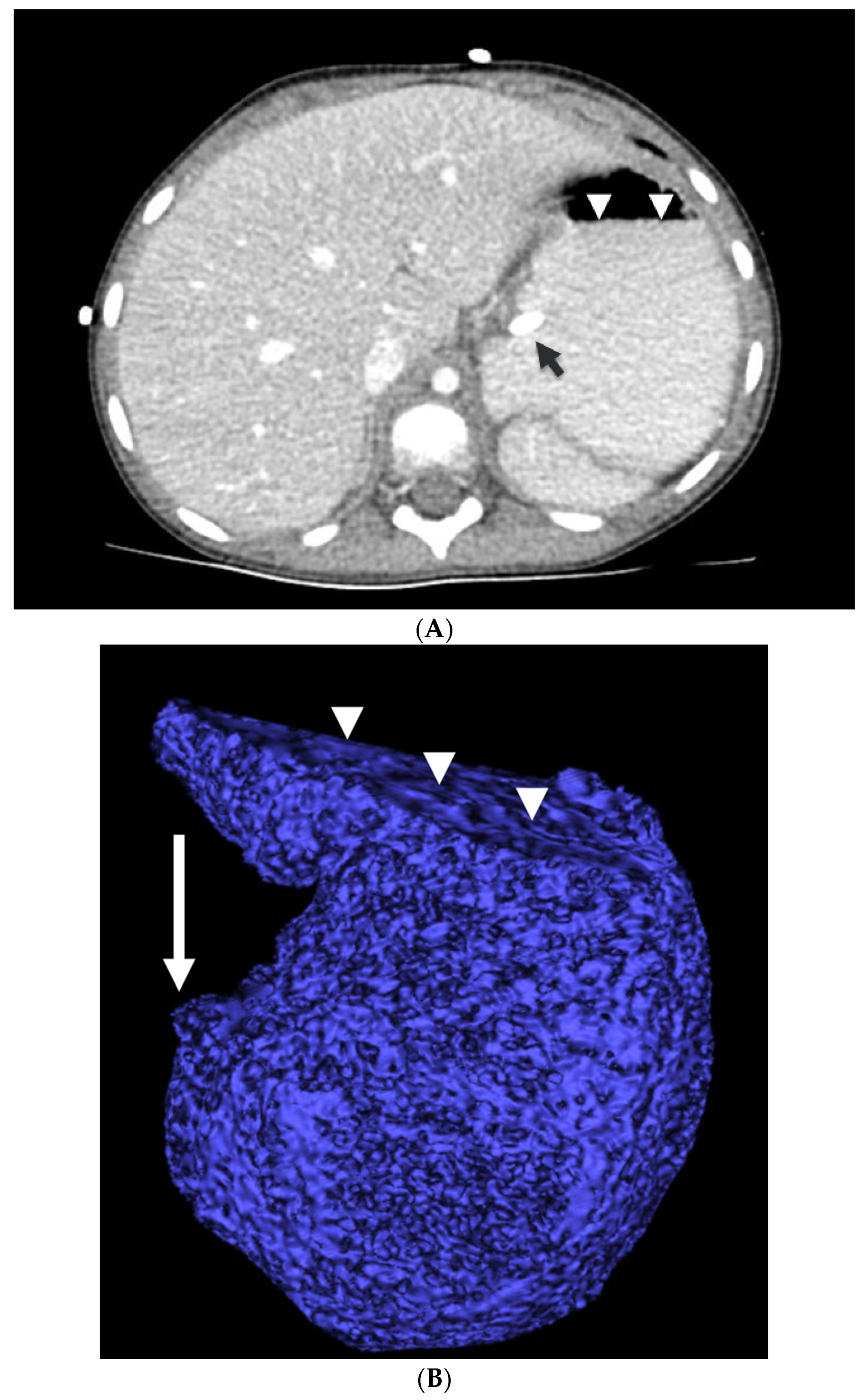 Jcm 13 03584 g001 Jcm 13 03584 g001
