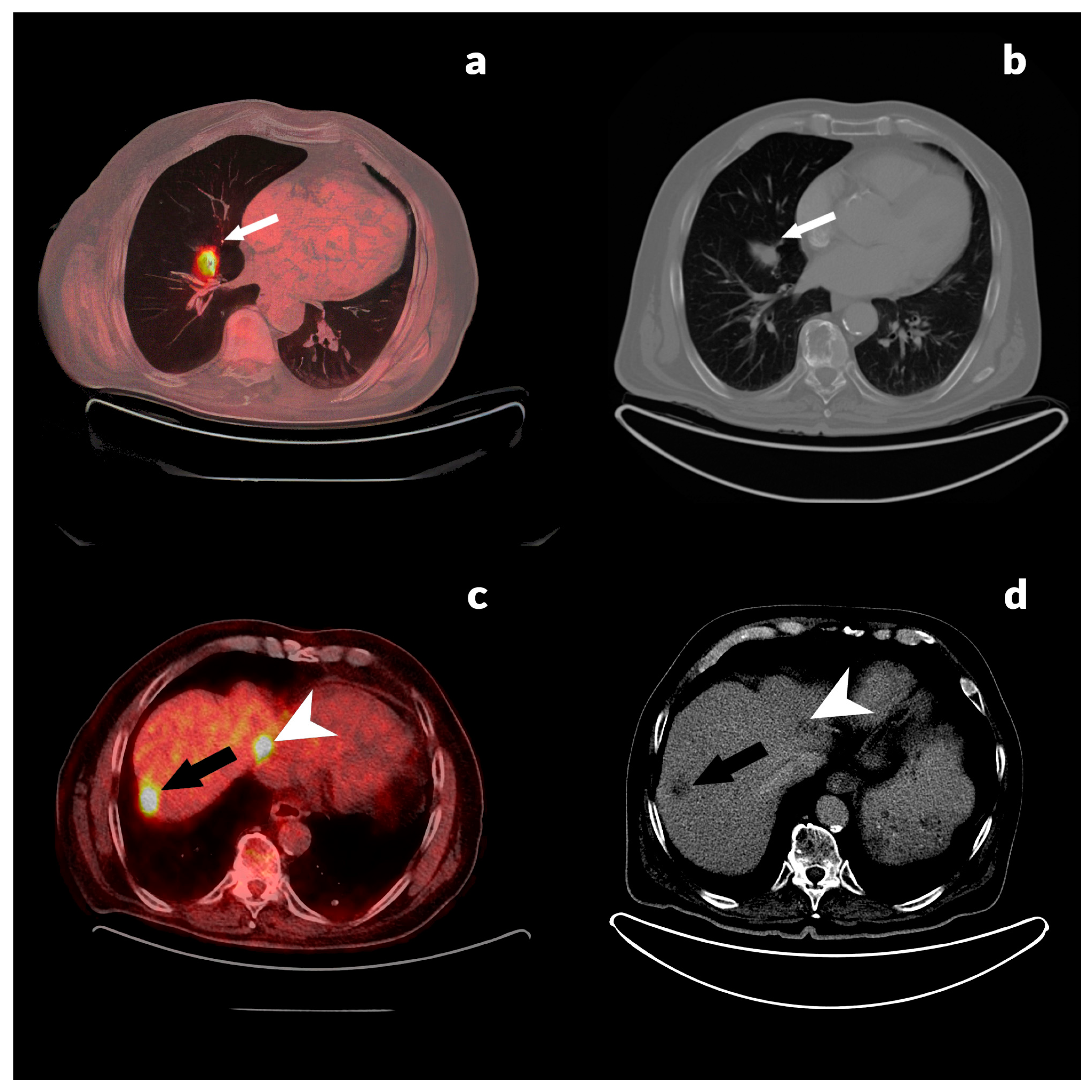 Jcm 13 03602 g001 Jcm 13 03602 g001