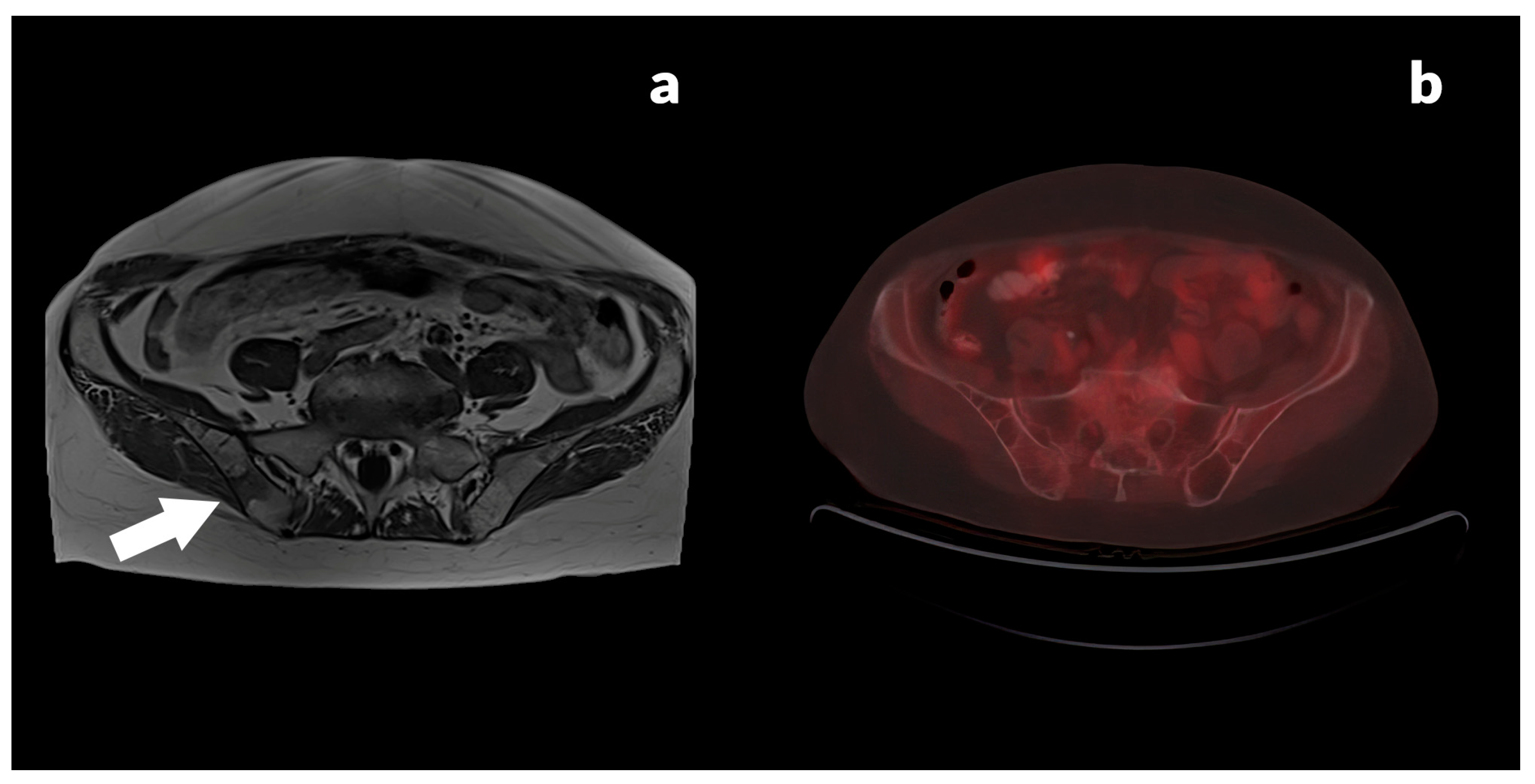 Jcm 13 03602 g002 Jcm 13 03602 g002