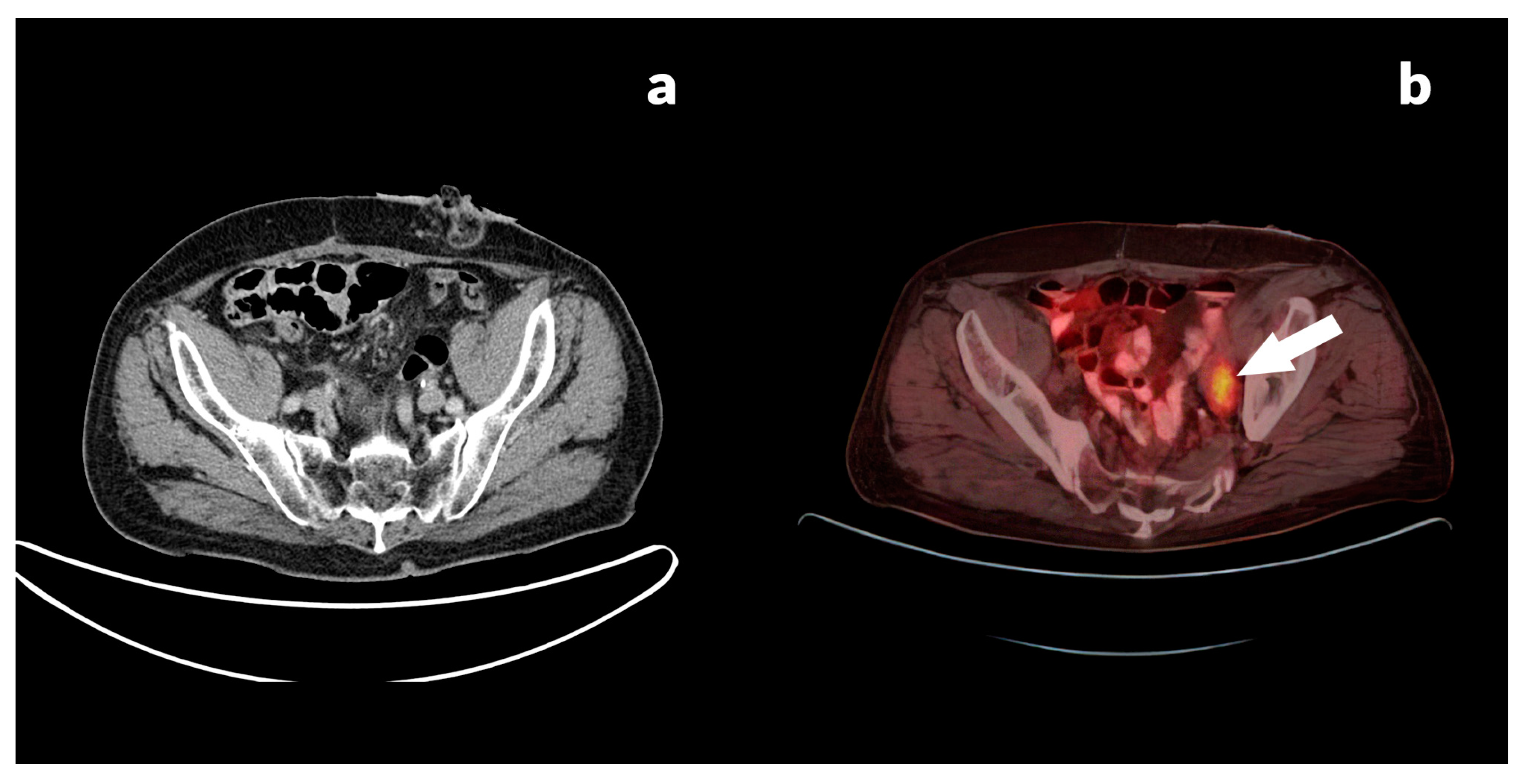Jcm 13 03602 g003 Jcm 13 03602 g003