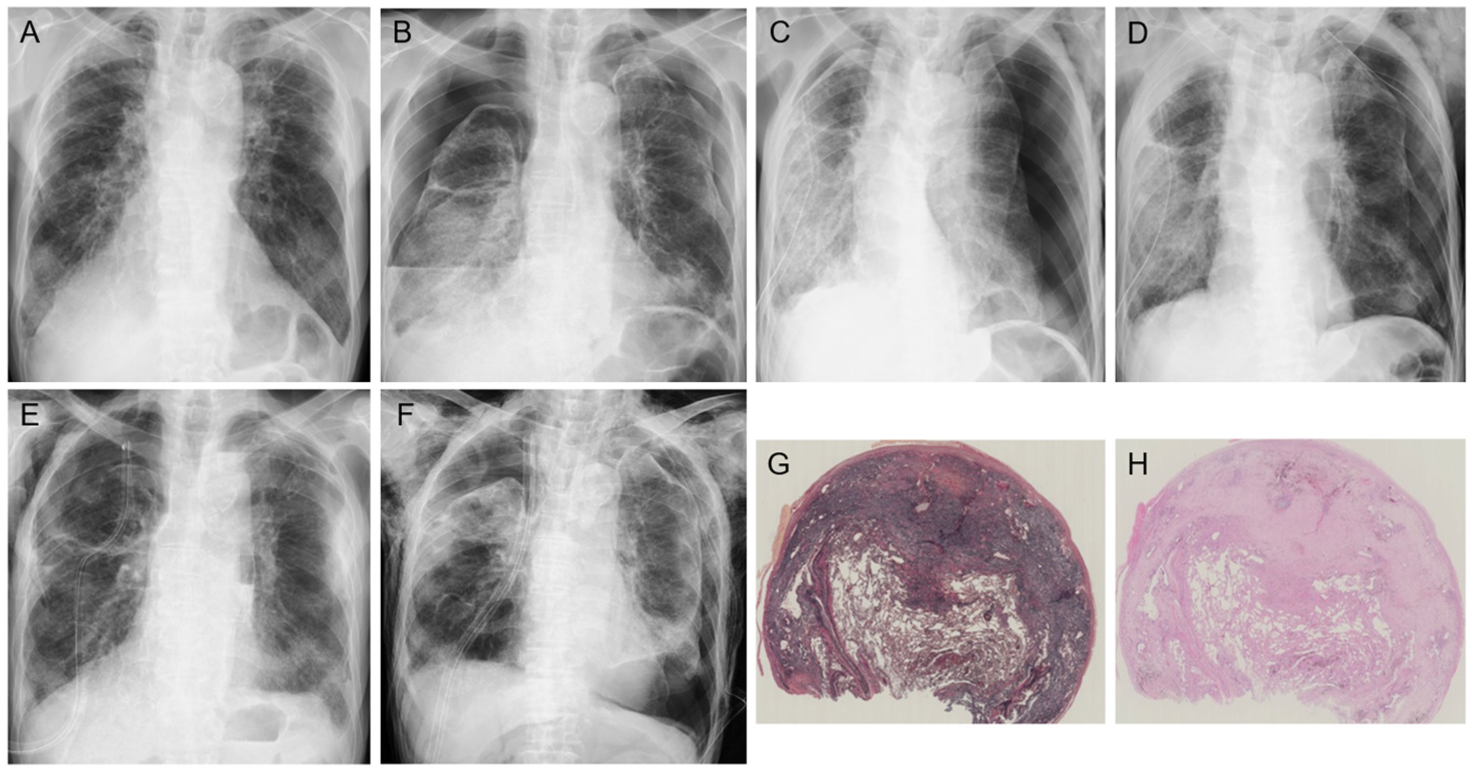 Jcm 13 03675 g005 Jcm 13 03675 g005