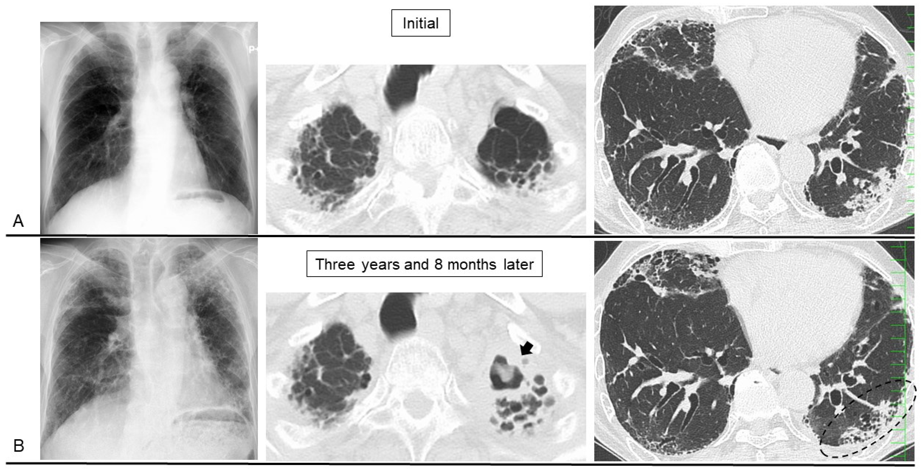 Jcm 13 03675 g006 Jcm 13 03675 g006