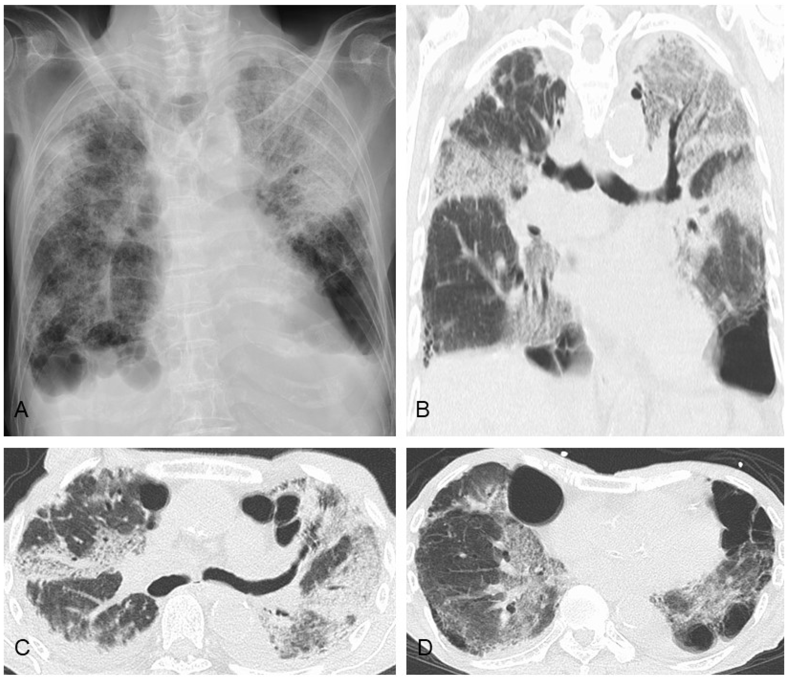 Jcm 13 03675 g007 Jcm 13 03675 g007