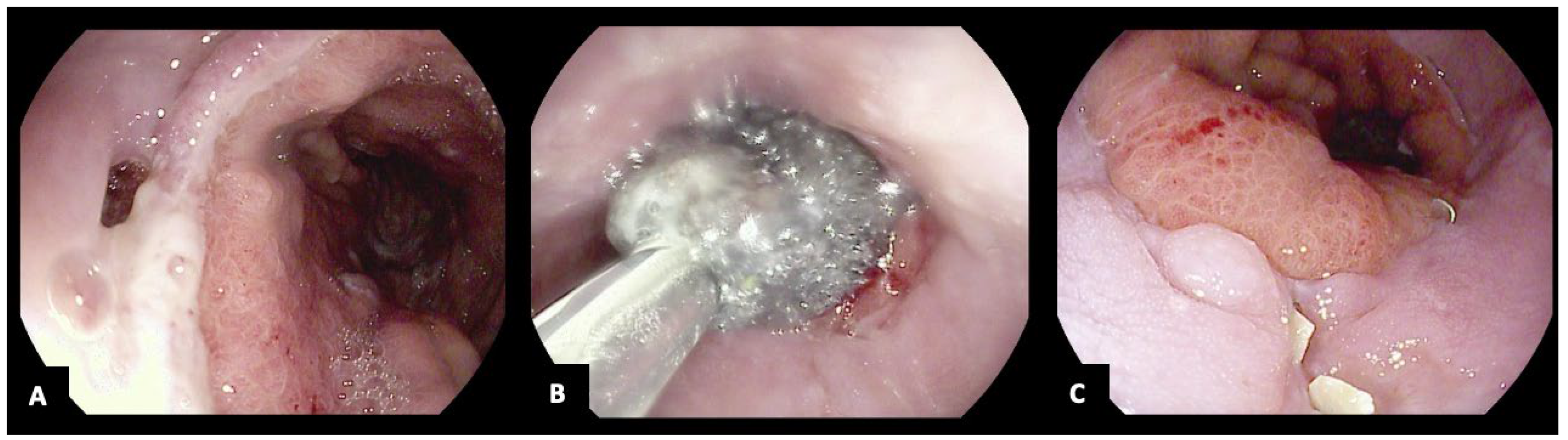 Jcm 13 03805 g002 Jcm 13 03805 g002