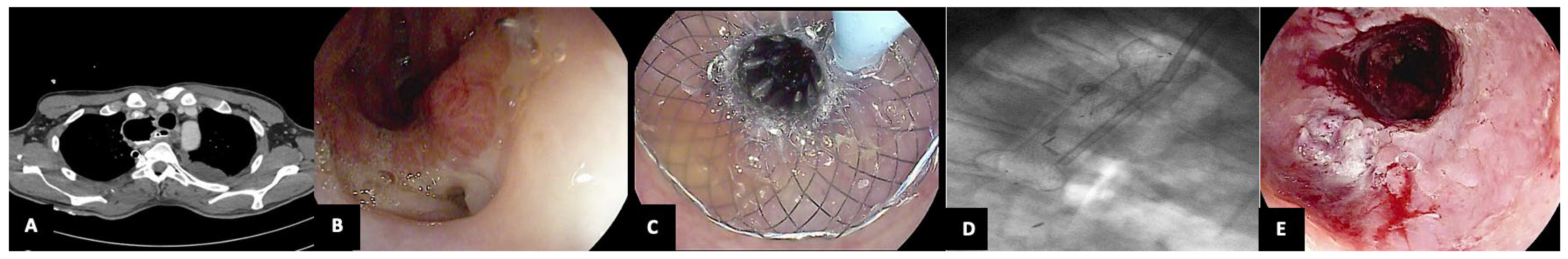 Jcm 13 03805 g004 Jcm 13 03805 g004