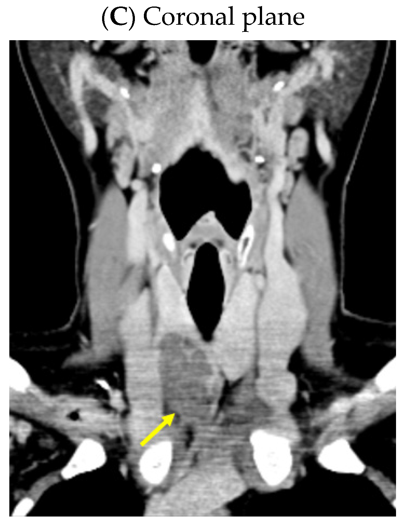 Jcm 13 03847 g001b Jcm 13 03847 g001b