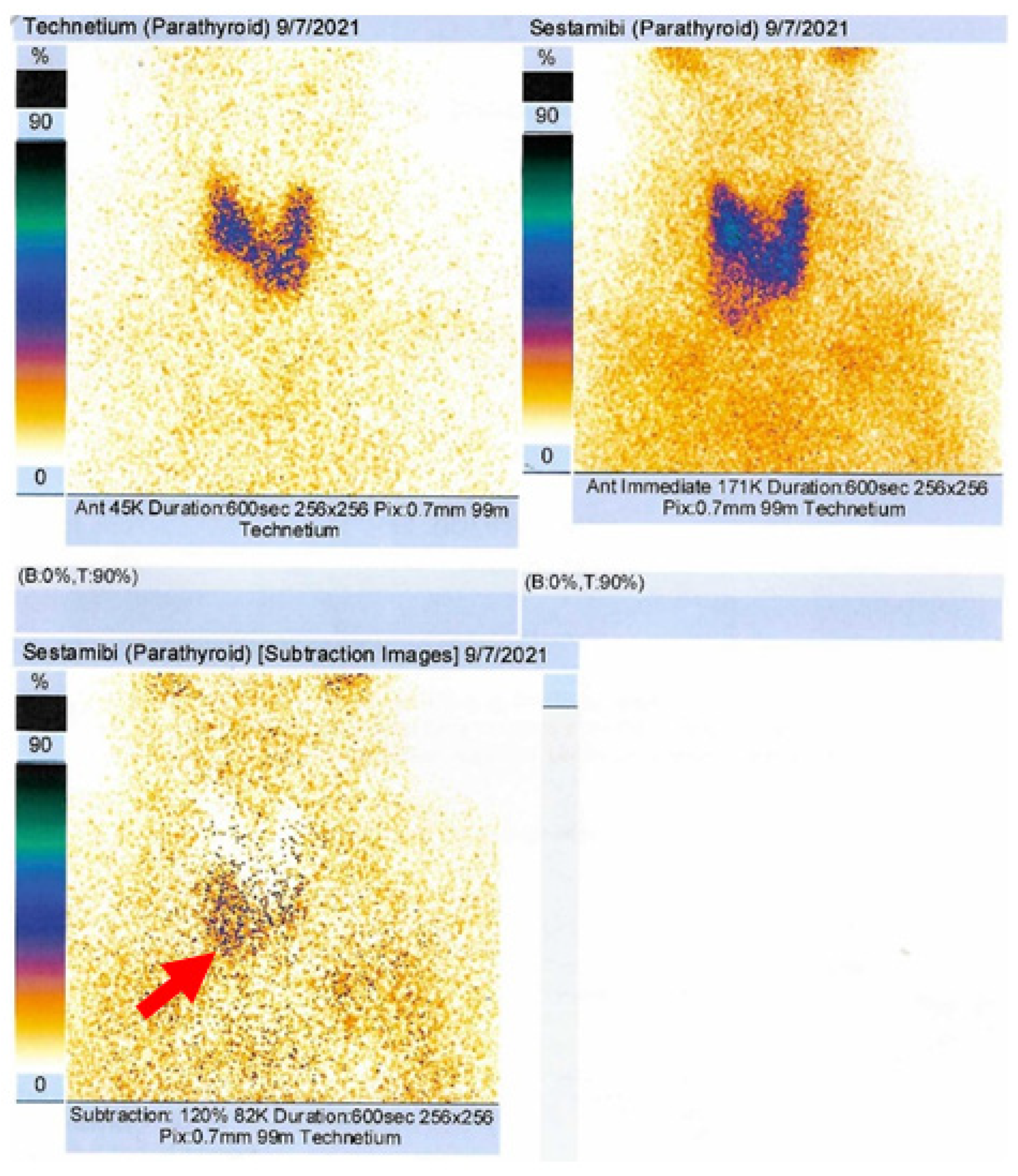 Jcm 13 03847 g002 Jcm 13 03847 g002