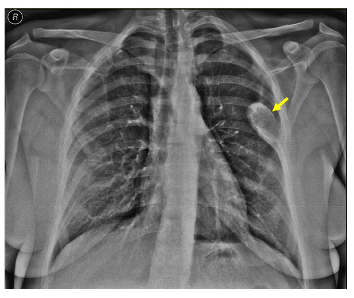 Jcm 13 03847 g003 Jcm 13 03847 g003