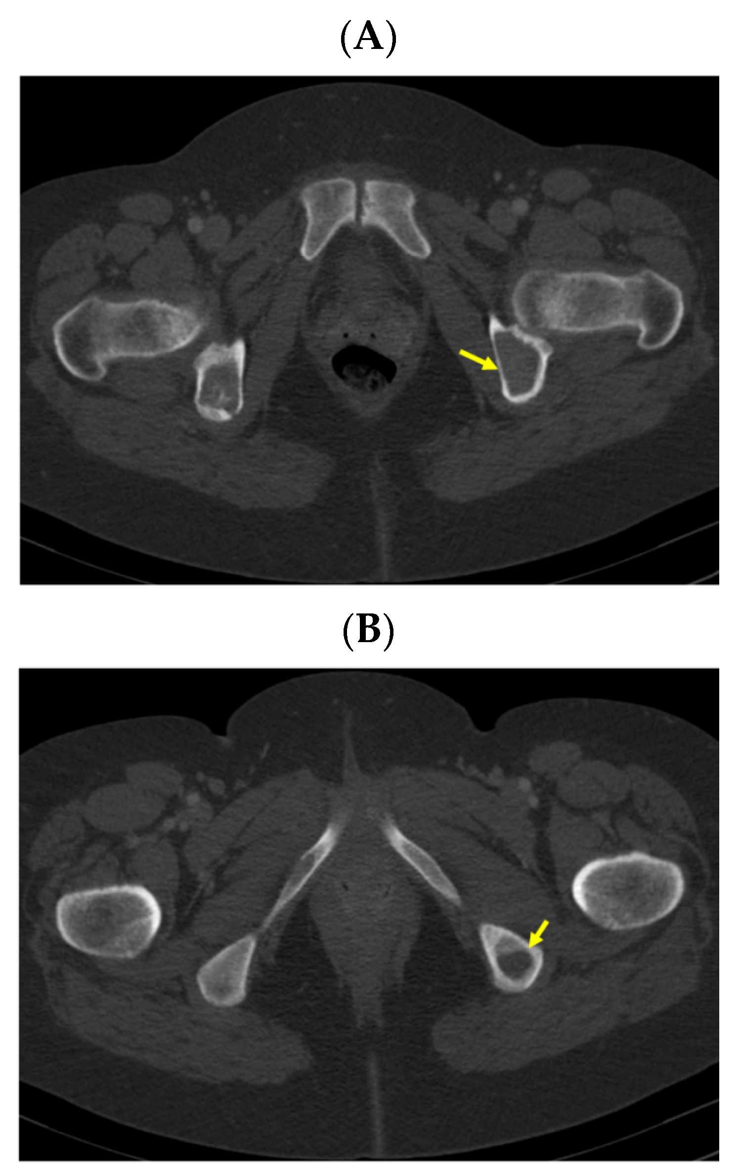 Jcm 13 03847 g006 Jcm 13 03847 g006