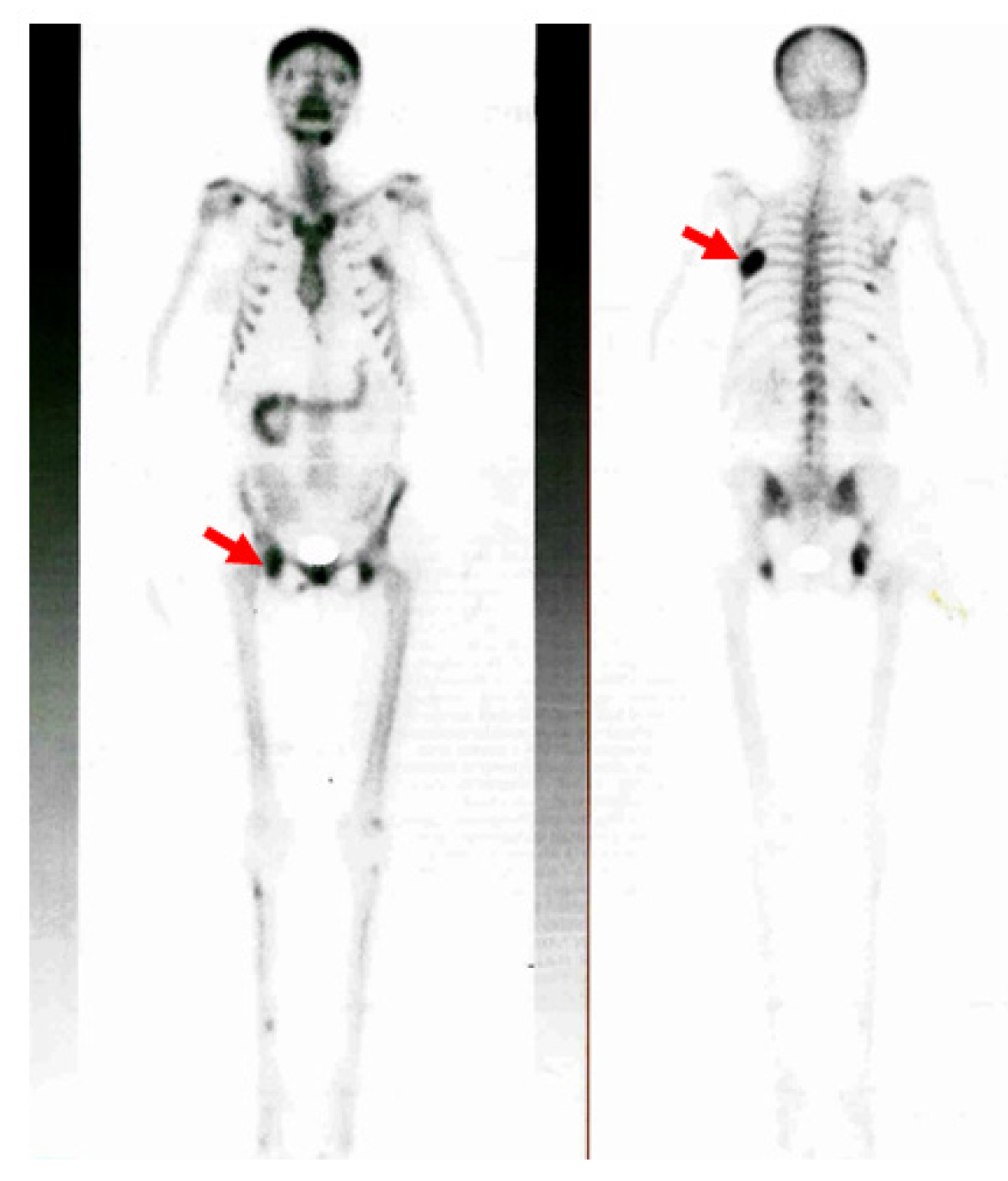 Jcm 13 03847 g007 Jcm 13 03847 g007