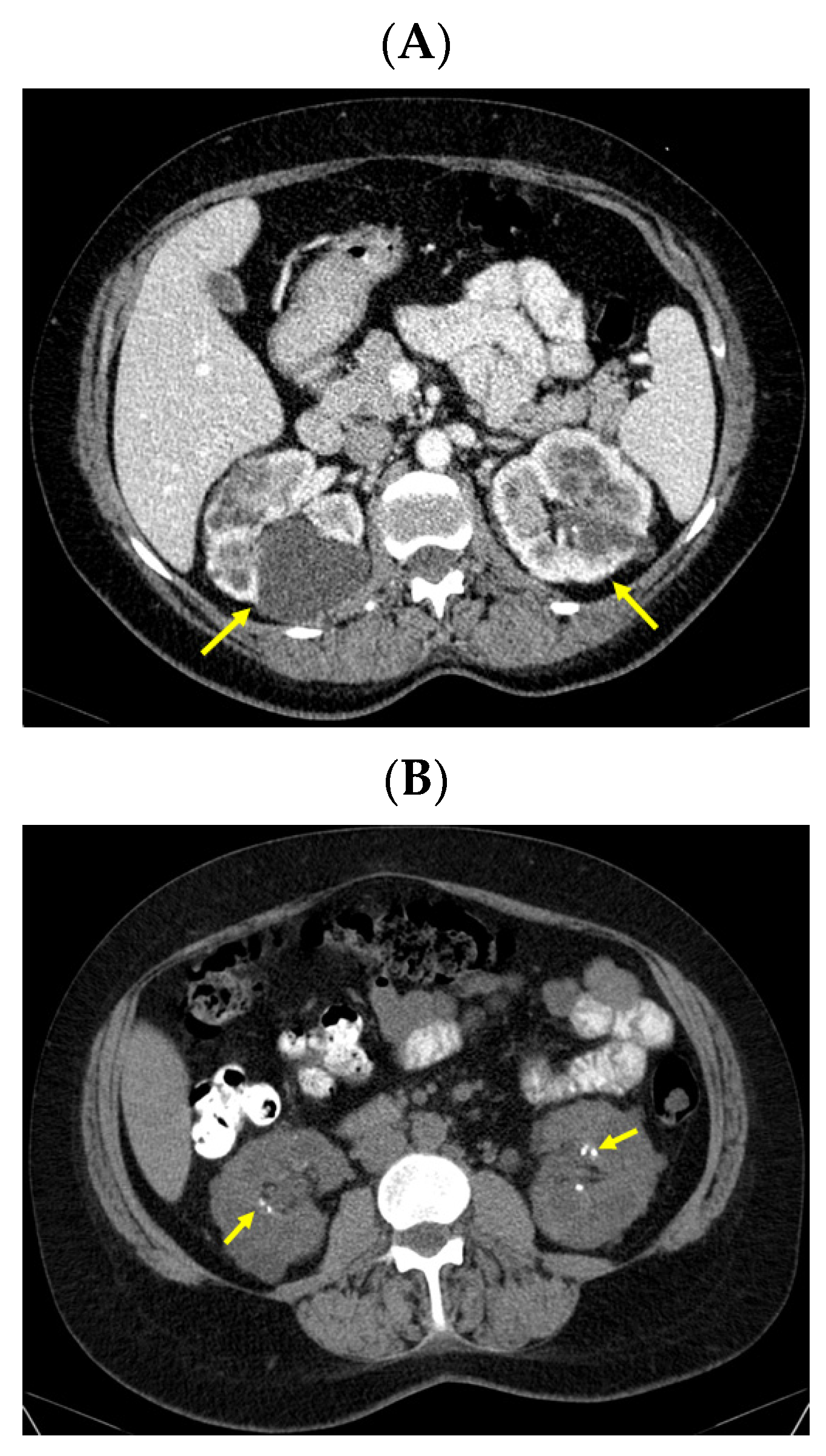 Jcm 13 03847 g008 Jcm 13 03847 g008