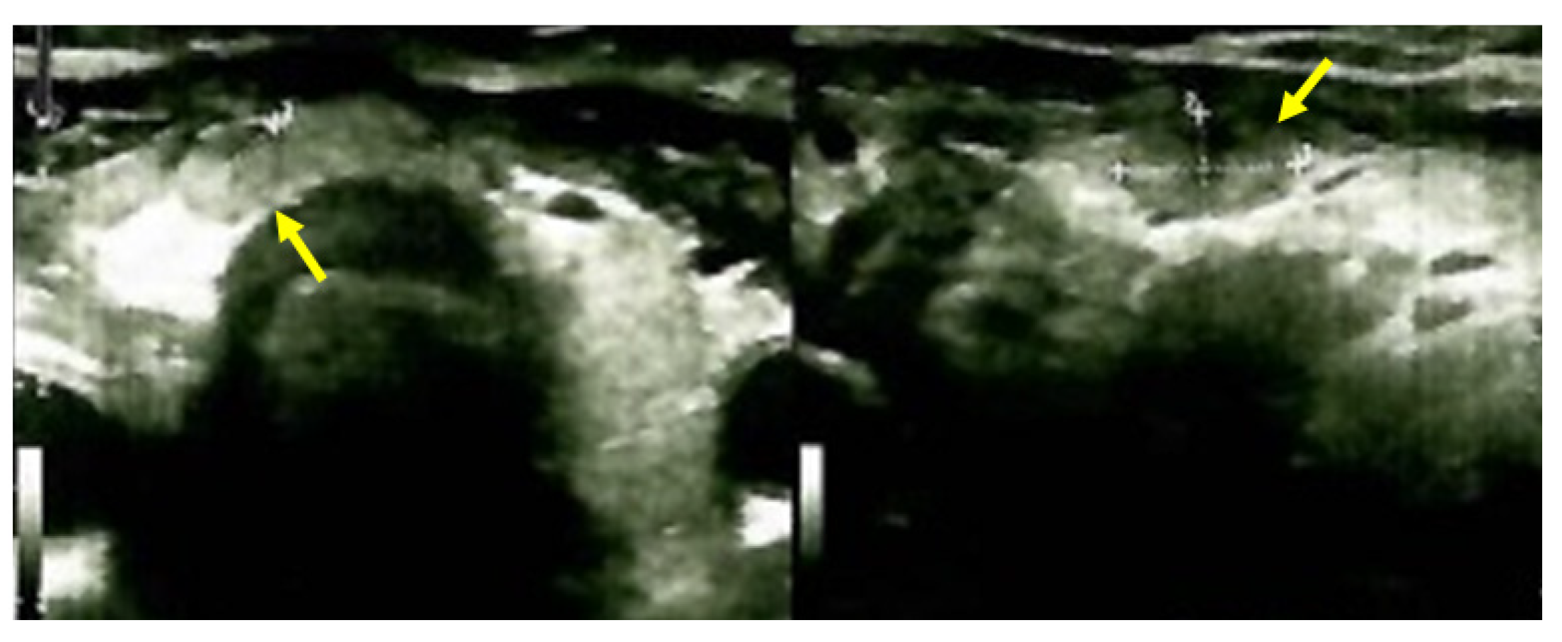 Jcm 13 03847 g011 Jcm 13 03847 g011