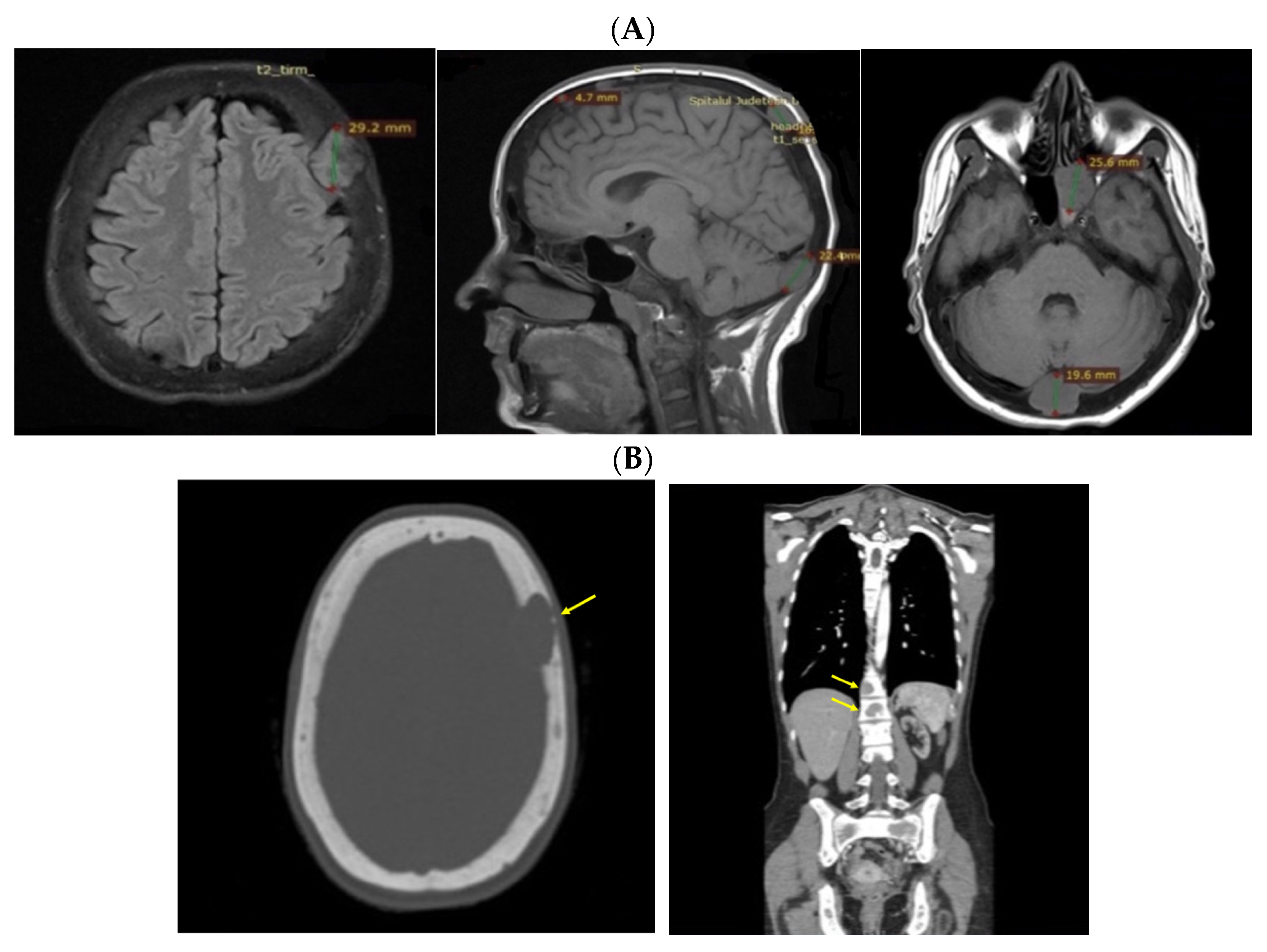 Jcm 13 03847 g012 Jcm 13 03847 g012