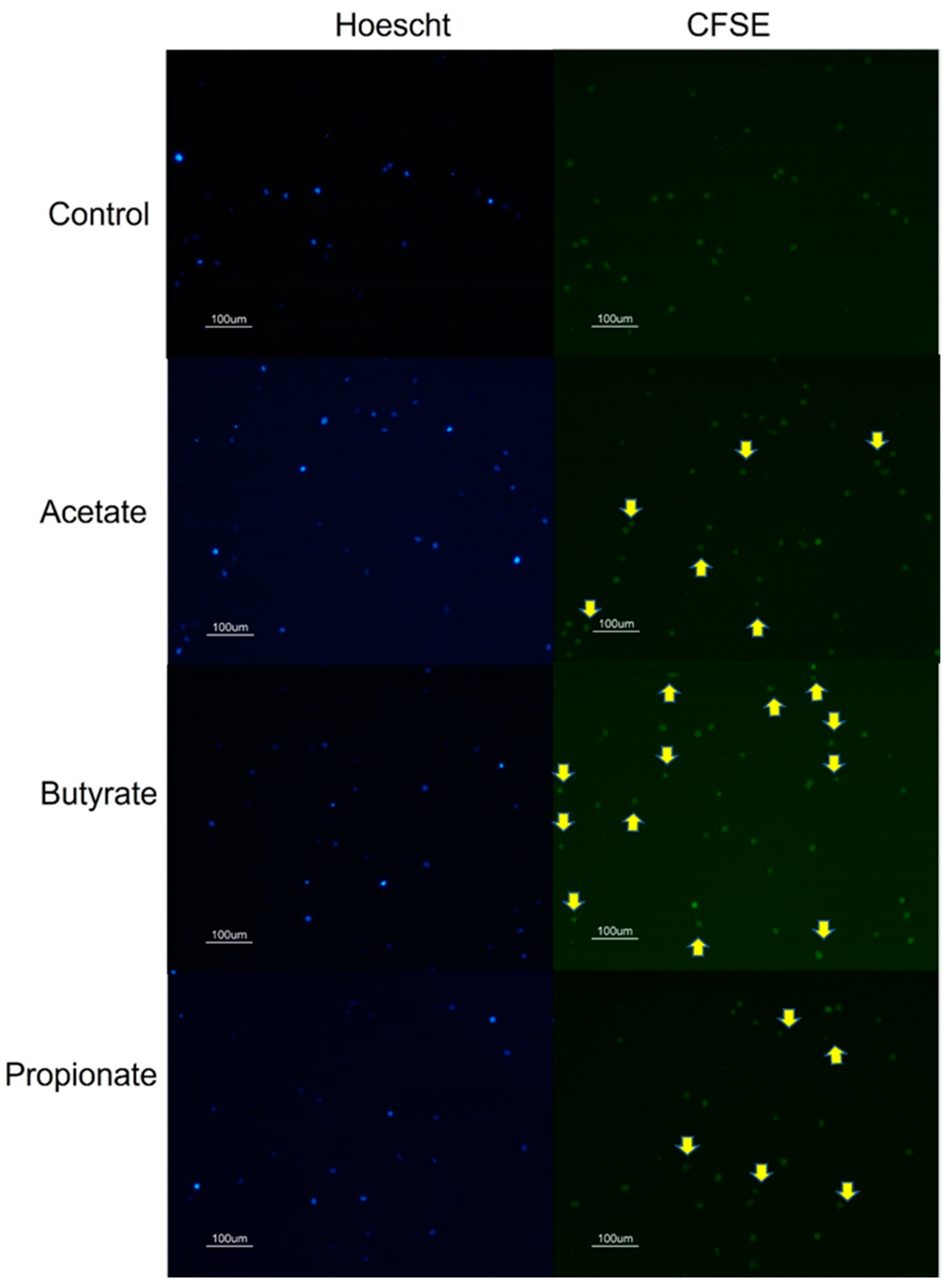 Microbiota-Derived Short-Chain Fatty Acids Boost Antitumoral