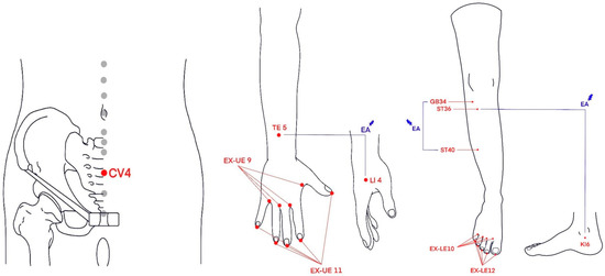Chuna Manual Therapy or Electroacupuncture with Pregabalin for Chemotherapy-Induced Peripheral Neuropathy: A Randomized Controlled Pilot Study