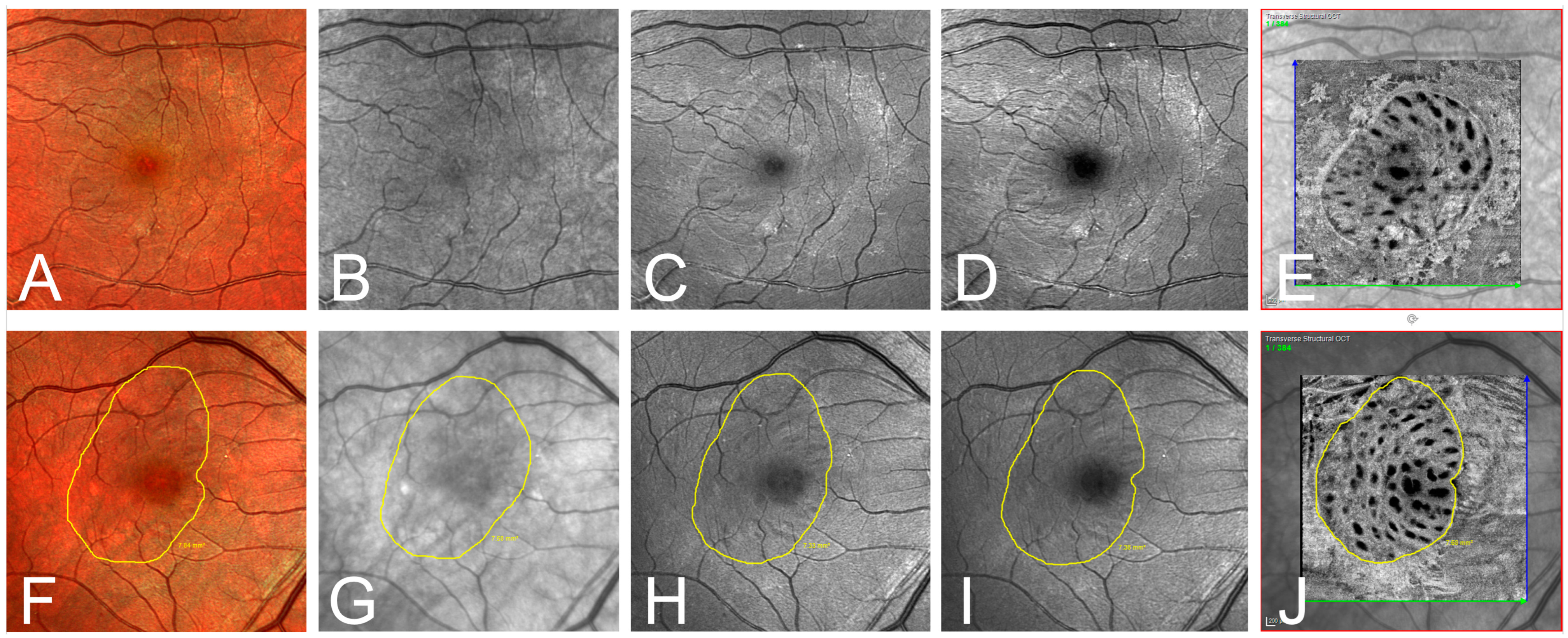 Jcm 13 03938 g003 Jcm 13 03938 g003